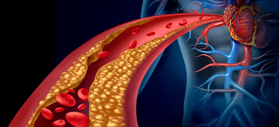 El colesterol es una sustancia grasa que circula en nuestro cuerpo, que es necesaria para muchas funciones vitales de nuestro organismo